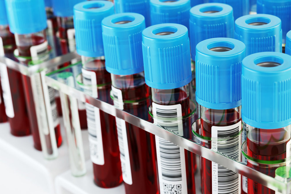 Testing kits use blood samples to detect COVID-19 pathogens.