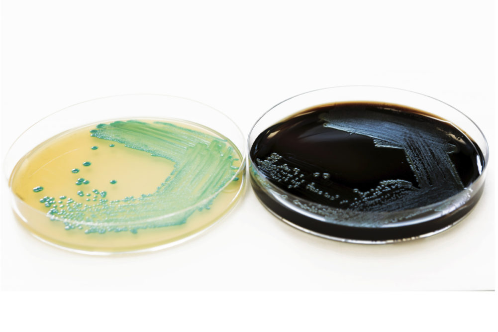 Listeria in petri dishes
