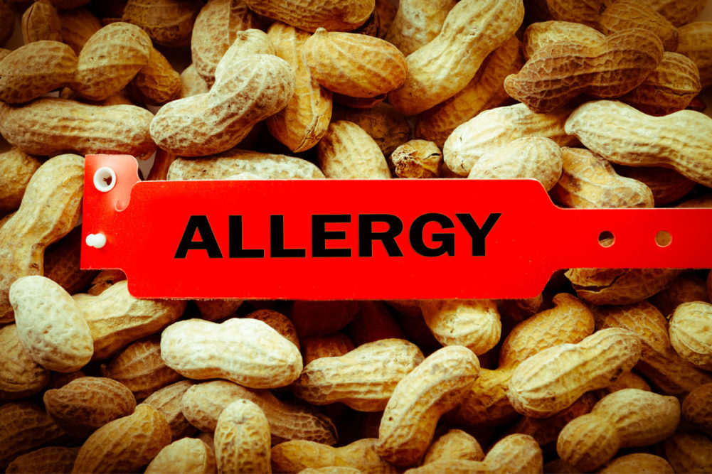 Peanut allergy image