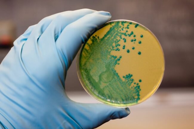 bacteria