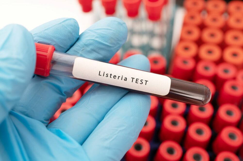 listeria